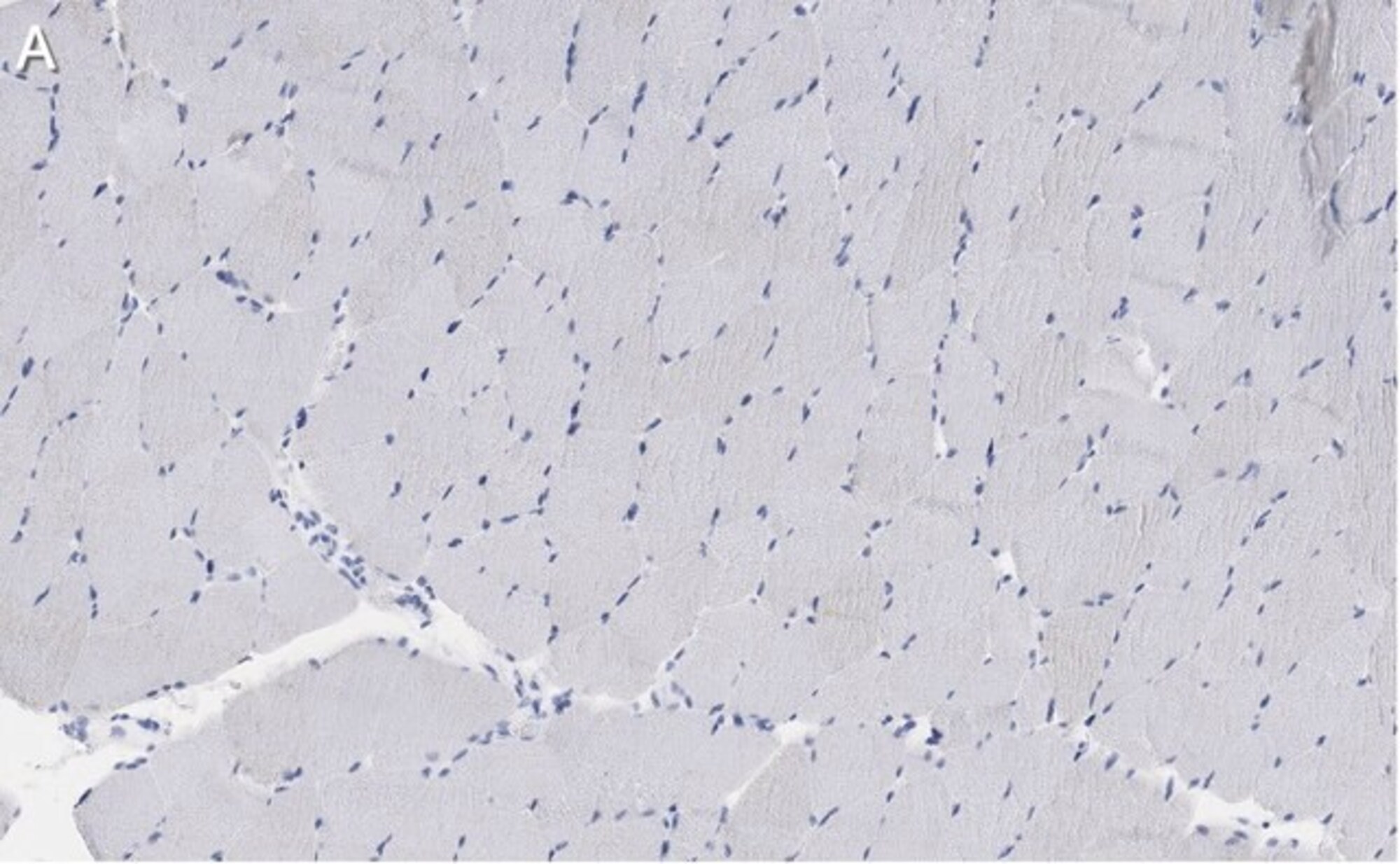 Sigma Aldrich / MilliporeSigma